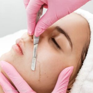 Dermaplaning Facials